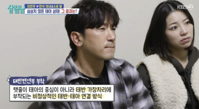 “변형 태반, 탯줄 목에 감아”…<b>이민우</b>, <b>2세</b> 검진에 긴장