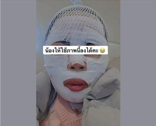  화상 입은 태국인 아내.페이스북 캡처
