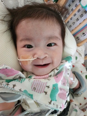 심장 몸밖 나온채 태어난 서린이…기적같은 수술 성공