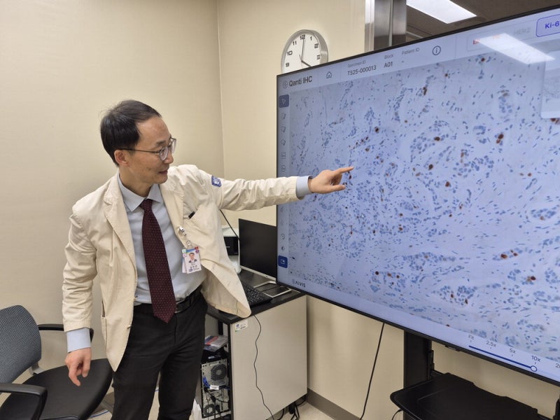의사가 놓친 심근경색 징후…AI가 "100% 위험" 판단해 사망 막아