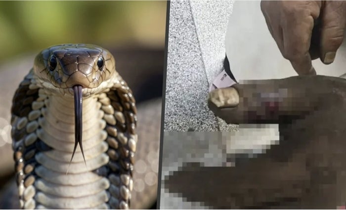 “독 빨아내면 산다?”…독사에 물린 남편 구하려다 아내도 병원행