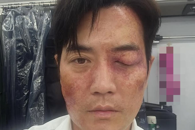 뉴스 이미지