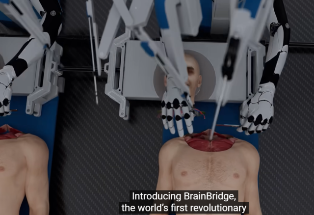 미국 스타트업 ‘브레인브릿지(BrainBridge)’가 지난달 22일 머리 이식술 그래픽 영상을 공개했다. Hashem Al-Ghaili 유튜브 캡처