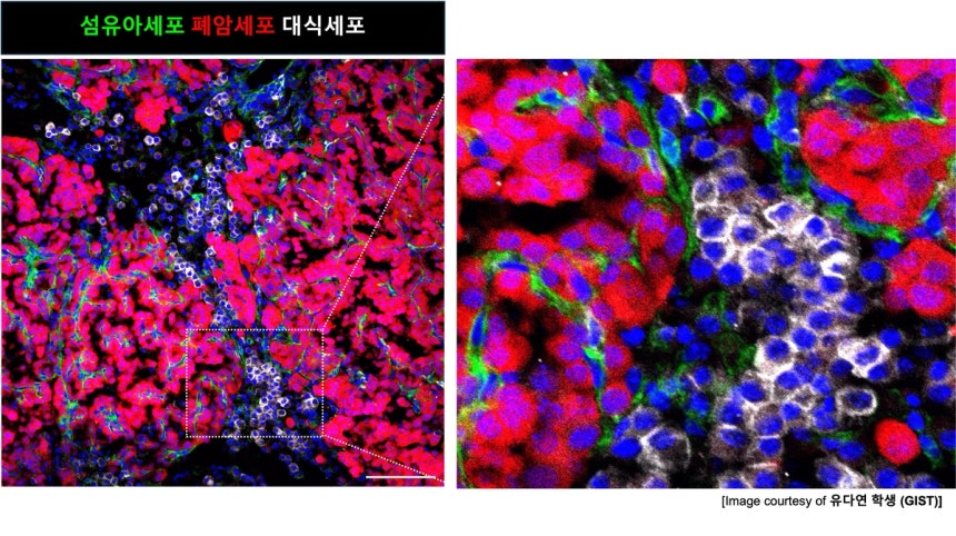 초기 폐암에서 돌연변이 줄기세포가 주변 환경을 바꾸는 과정도.GIST 제공