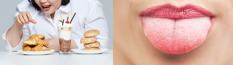 혀에 낀 ‘<b>설태</b>’ 그대로 뒀다간..."뚱뚱해질 수 있다" [헬스톡]
