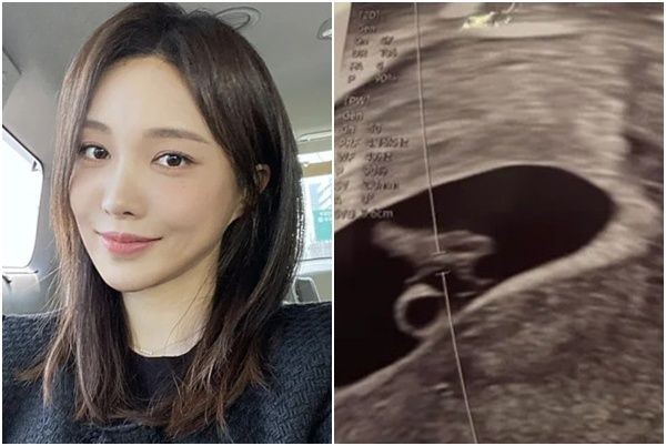 <b>서민재</b> "<b>임신 9주</b>차…남친 <b>연락두절</b>, 아버지로서 책임 다하길"