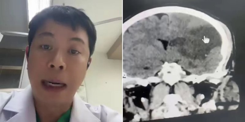 태국 치앙마이에서 활동하는 신경외과 전문의 프라차가 SNS에 잘못된 마사지의 위험을 알린 글을 올렸다./사진=프라차 페이스북,<a href=