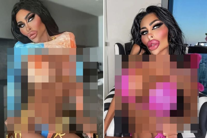 1억 넘게 쓰고 인간 바비 됐다는 여성 현재 건강상태 심각하다