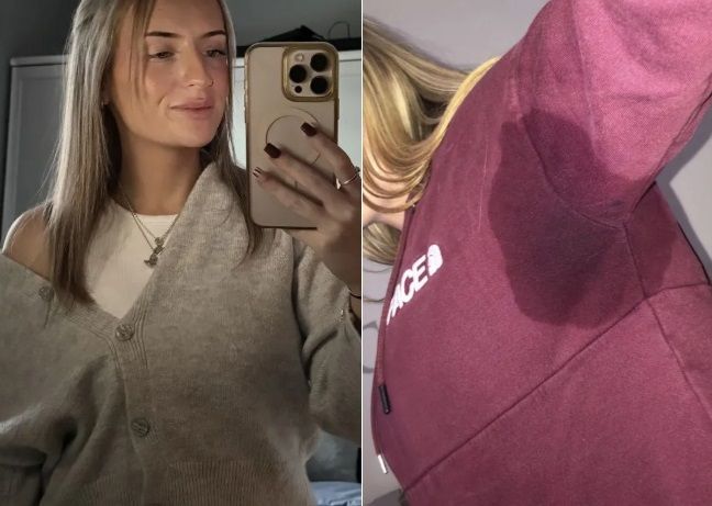 땀 3리터 흘려 친구들에게 더럽다고 손가락질 당한 20대 여성의 사연