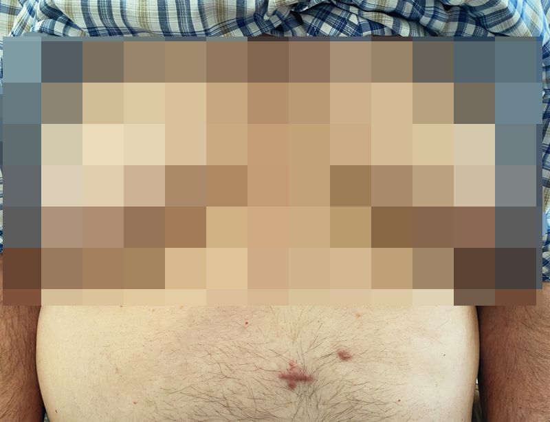 /사진=뉴잉글랜드의학저널(The New England Journal of Medicine) 갈무리