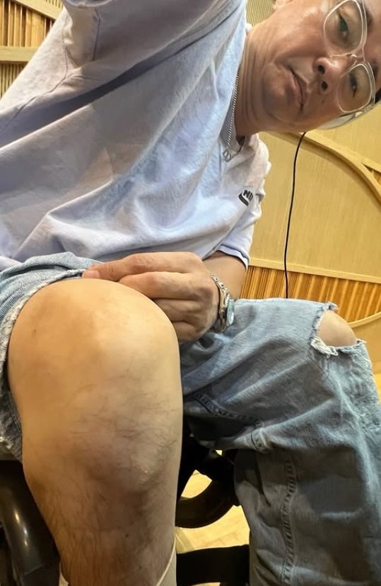 강원래님 발톱 빠져도 감각 없는 현실…김송님 25년 내조 감동 ㅠㅠ