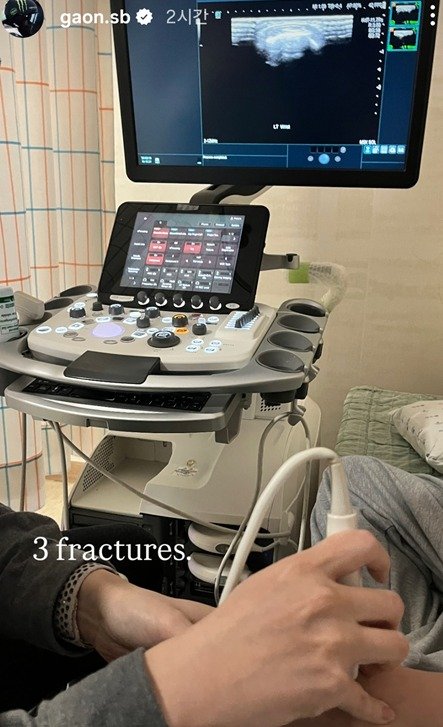 최가온이 SNS를 통해 골절 진단 소식을 전했다. /사진=뉴스1