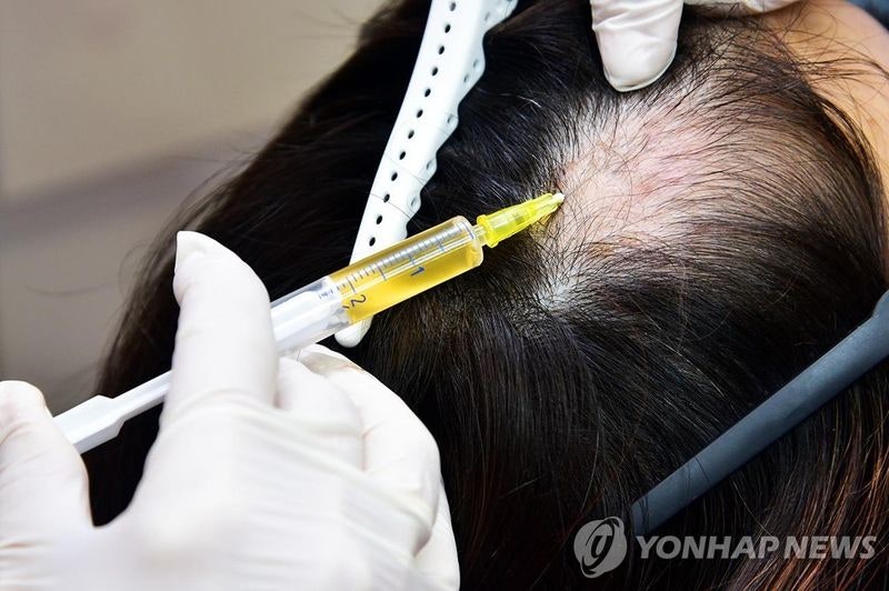 "탈모가 말기암 환자보다 중하냐"…중증질환 환자단체, 건보 확대 '포퓰리즘' 반발