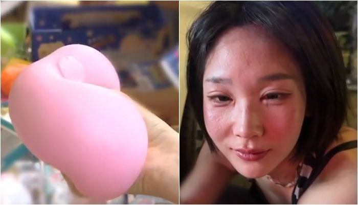 '이 장난감' 만졌다가 '얼굴 퉁퉁'... 급성 알레르기로 응급실행 [헬스톡]