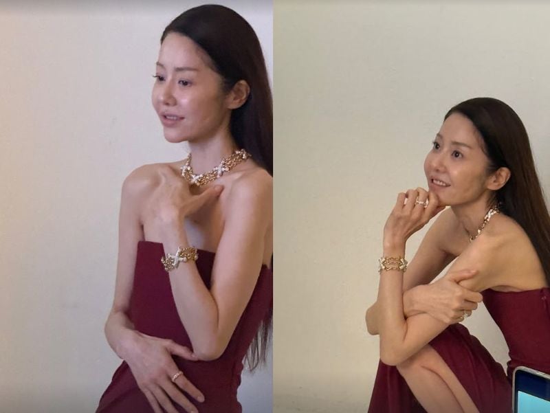 앙상하게 마른 고현정, 다이어트가 아니라 거식증 수준 음식 거부?