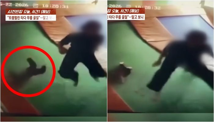 3살 아이가 어린이집 행사로 찾은 키즈카페에서 트램펄린을 타다 무릎 골절과 성장판 손상을 입는 사고를 당했다./사진=사건반장 캡처