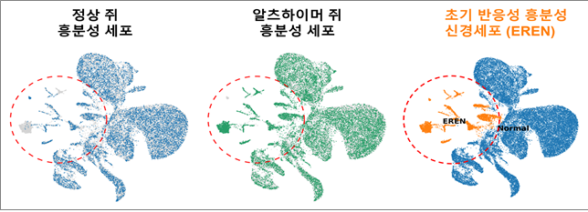 <b>알츠하이머</b> 악순환 끊을 핵심 스위치 찾았다
