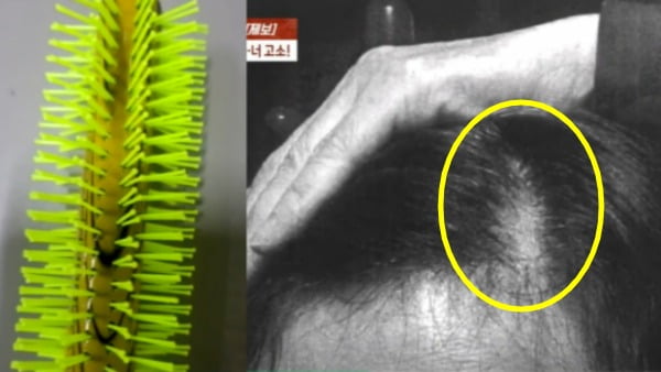 목욕탕에 방문한 손님이 '빗 때문에 머리가 뽑혔다'며 소장에 제출한 증거 사진. /사진=JTBC '사건반장' 방송화면 캡처