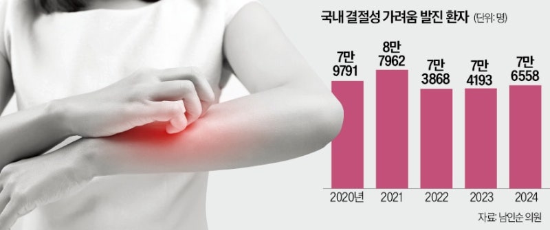 극심한 가려움에 환자 60%가 수면장애…치료제 도입 절실