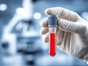 혈액 속 암 치료 나침반 '순환종양 DNA'