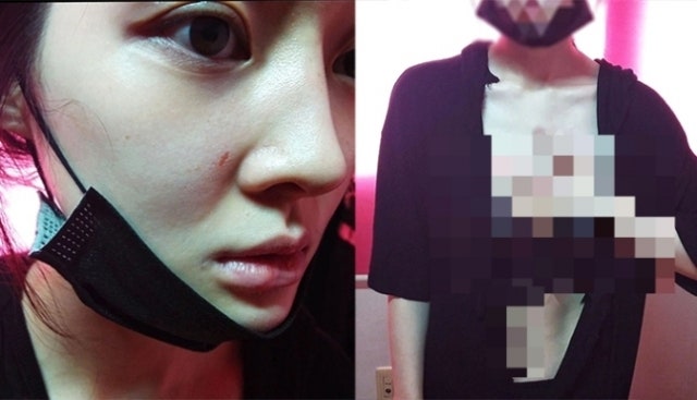 남편 가정폭력 폭로 티아라 아름, 극단적선택 시도