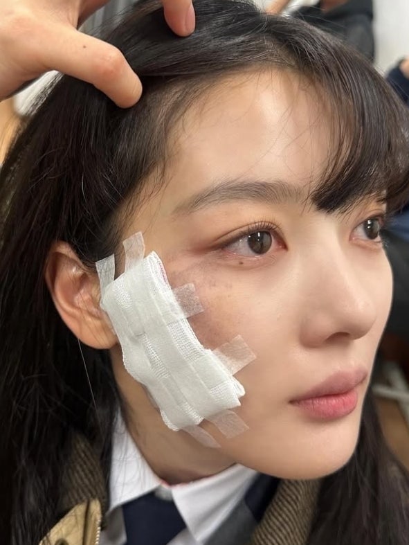 0002558071_001_20251114194017821.jpg?type=w800