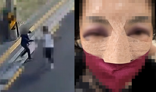 80대 할머니 폭행한 30대, 상습범인데 집행유예 선고 말이 되냐