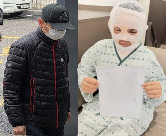 "또 그럴 듯"...'아내에 끓는 물' 40대, 징역 3년에 6개월 더