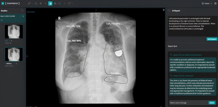 M4CXR 작동 이미지 / 출처=딥노이드