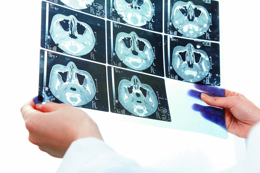 최근 저선량 흉부 컴퓨터 단층 촬영 검진이 확대되면서 불필요한 절제를 피하고 정상 폐 조직을 보존하는 정밀 수술이 늘고 있다. 게티이미지코리아