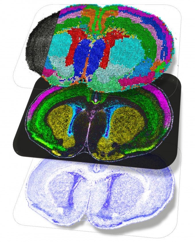 뇌세포는 출생 후에도 계속 발달… 포유류 ‘뇌 발달 지도’ 첫 구축
