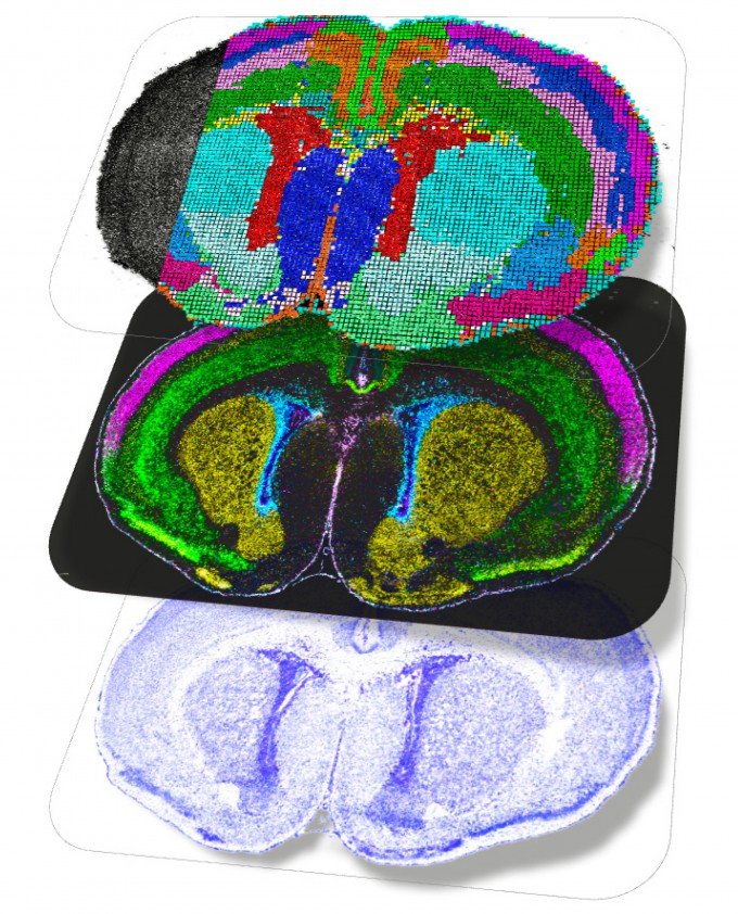 출생 직후 쥐의 뇌 공간 지도. 단백질이나 리보핵산(RNA) 등이 실제로 뇌의 어느 위치에서 상호작용하는지를 보여준다. 네이처 제공