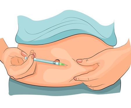 제1형 당뇨병 환자는 췌장에서 인슐린이 거의 분비되지 않아 인슐린 주사를 맞아야 한다. 최근 줄기세포를 이용해 위 기능을 모사한 오가노이드(장기유사체)에서 인슐린이 분비되도록 만드