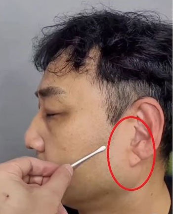 “<b>김수용</b> 귓불 주름, <b>심근경색</b> 전조? 노화현상”…전문의 진단