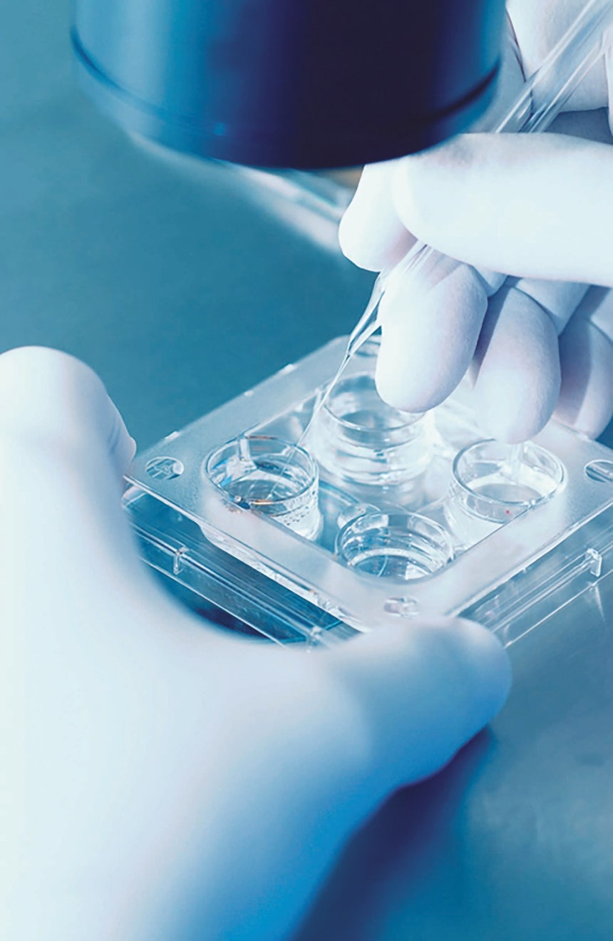 2024년 ‘레즈디프라’ 출현으로 대사이상 관련 지방간염(MASH) 치료제 시대가 열리면서 간·대사질환 분야가 제약업계의 핵심 격전지로 부상한 가운데 대형 제약 기업들이 앞다퉈 공