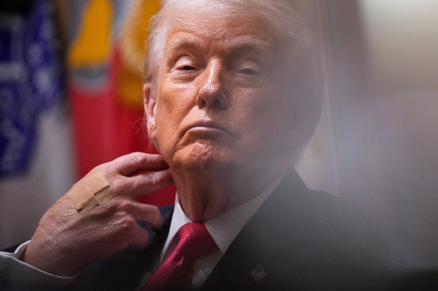 2일(현지 시간) 미국 백악관에서 각료회의를 주재하는 도널드 트럼프 대통령의 오른쪽 손등에 반창고가 붙어 있다.2025.12.03.워싱턴=AP/뉴시스