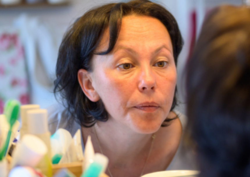 불독살은 노화,자외선,<a href=