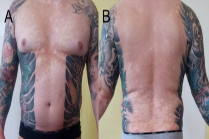 사진=Clinics and Practice