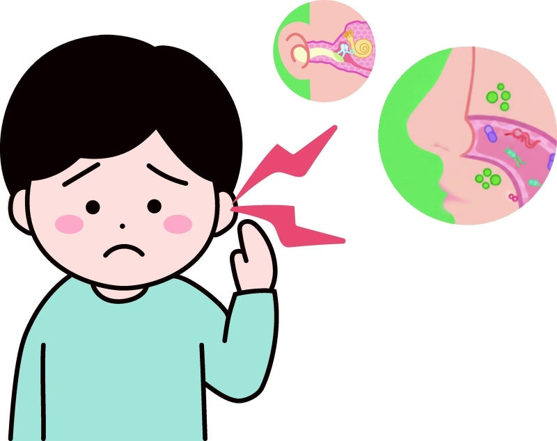 초등생 중이염 오래가면, 코 뒤쪽 ‘아데노이드 서식 세균’ 의심