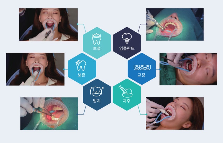 히포 D의 각종 이용 사례 / 출처=네오덱스