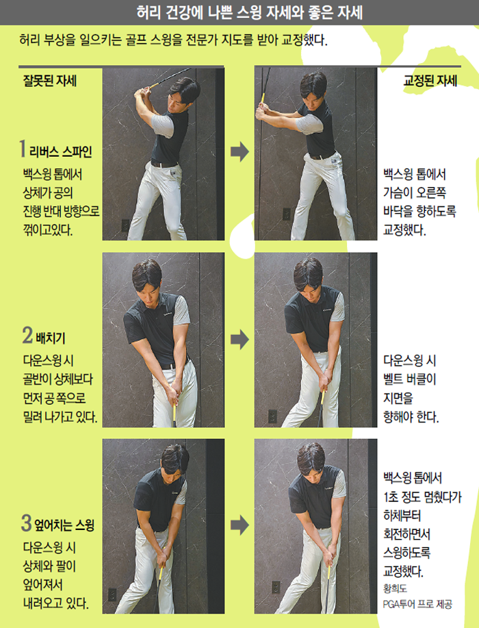 홀인원 욕심내다가 허리 삐끗… 원인은 ‘잘못된 스윙’[이진한 의학전문기자의 메디컬 체험]