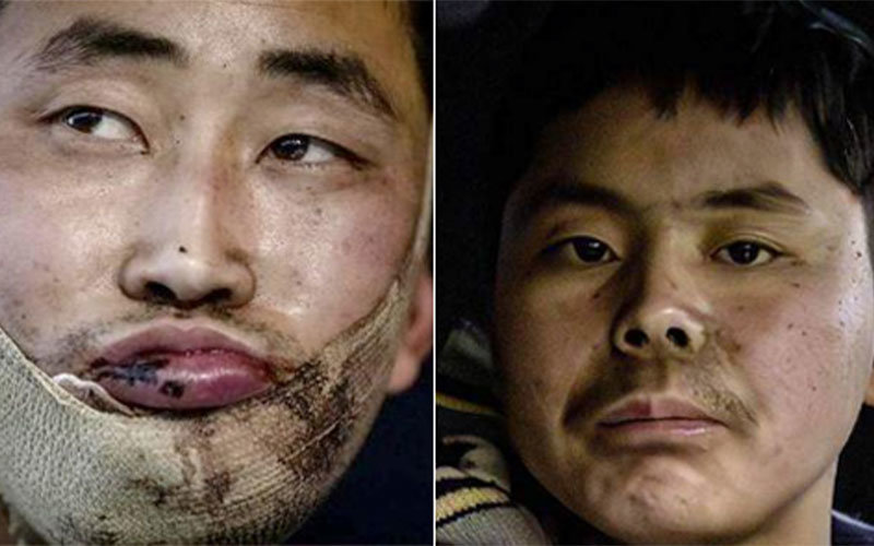 우크라이나군이 러시아 쿠르스크에서 생포한 북한군.볼로디미르 젤렌스키 우크라이나 대통령 텔레그램 캡처