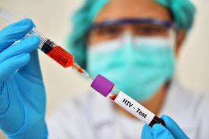 에이즈는 금방 죽는다? 조기 발견 땐 억제 가능[김규회의 뒤집어보는 상식]