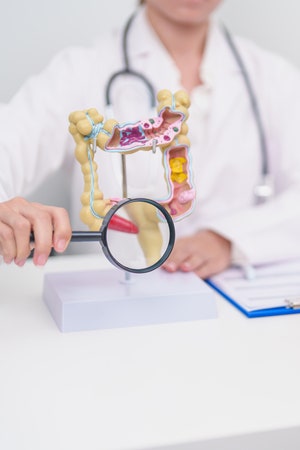 2030 대장암 급증… 햄·소시지 섭취 줄여야