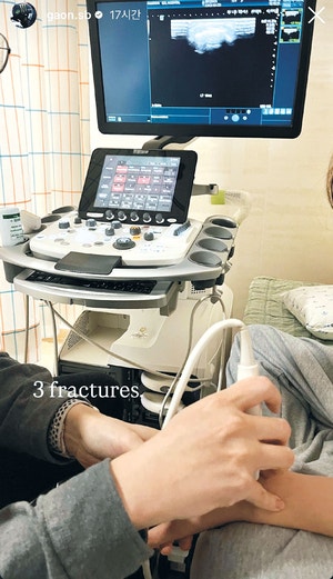 金 잡은 최가온, 경기때 손바닥뼈 3개 골절돼 있었다[2026 밀라노·코르티나 동계올림픽]