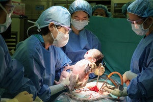 ‘빅5’ 중 최다 분만 아산병원, 1월 고위험분만 329건 달성