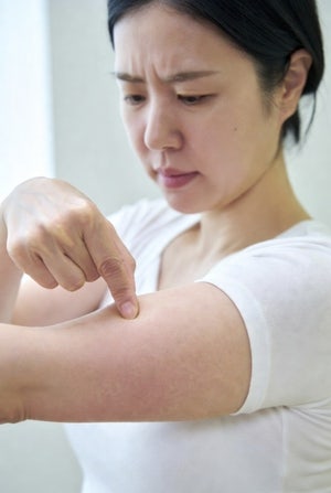 Q : 체중이 조금만 늘어도 강박이 심해지고 우울해집니다[마음상담소]