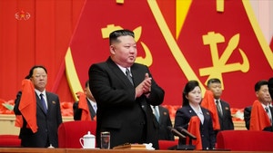 “김정은 몸무게 140㎏ 초고도비만… 건강 이상징후는 없어”