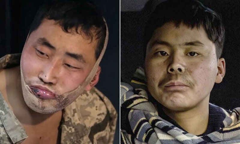우크라 ‘北 <b>포로송환 공개</b>’ 논란에… 靑 “일관된 원칙 대응”