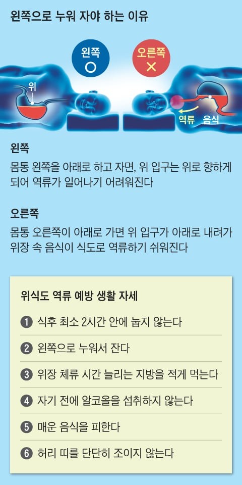 위식도 역류병 60대 최다… 잘 때 왼쪽으로 누우면 증상 줄어듭니다